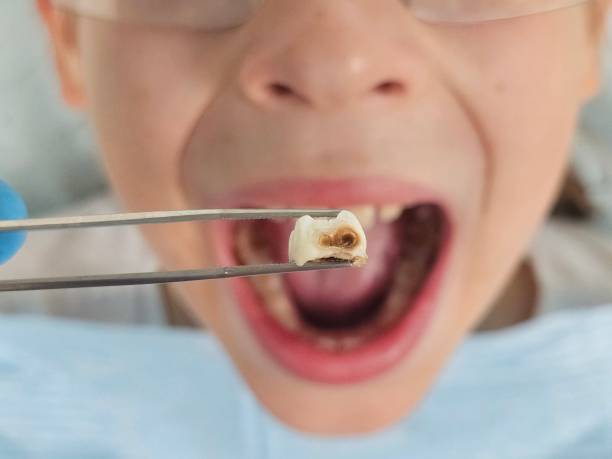 Best Emergency Cosmetic Dentistry (e.g., broken veneers) in La Vergne, TN